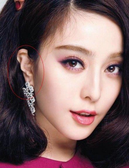 明星耳朵缺陷,揭秘明星独特耳朵缺陷的魅力